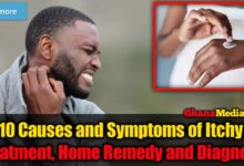 Top 10 Causes and Symptoms of Itchy Skin